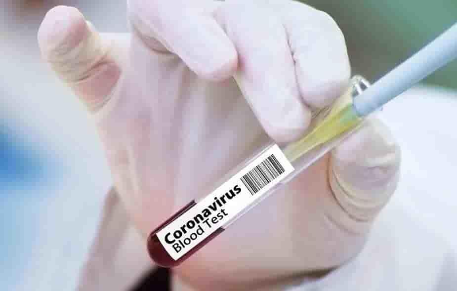 Vacuna contra COVID-19 pasa primera fase de pruebas: Rusia