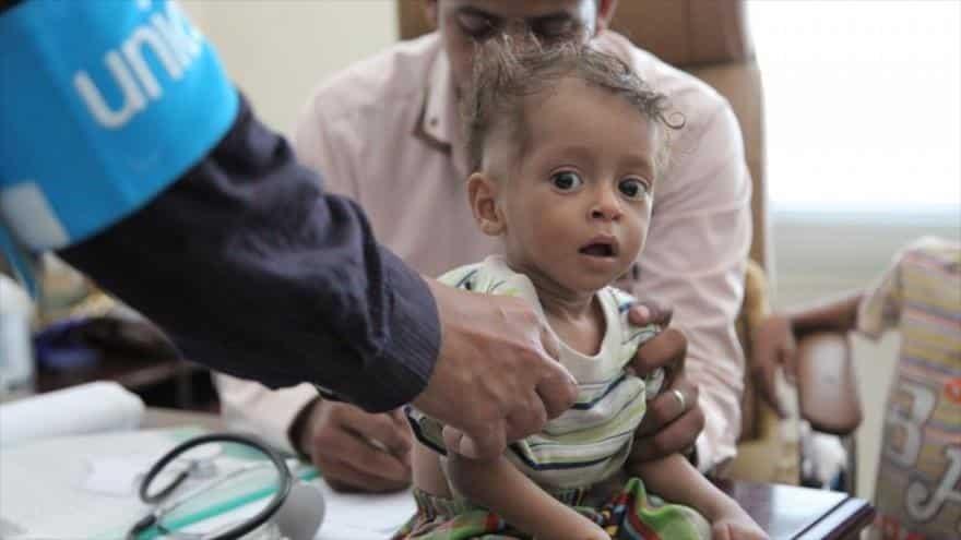 Está Yemen al borde de la hambruna