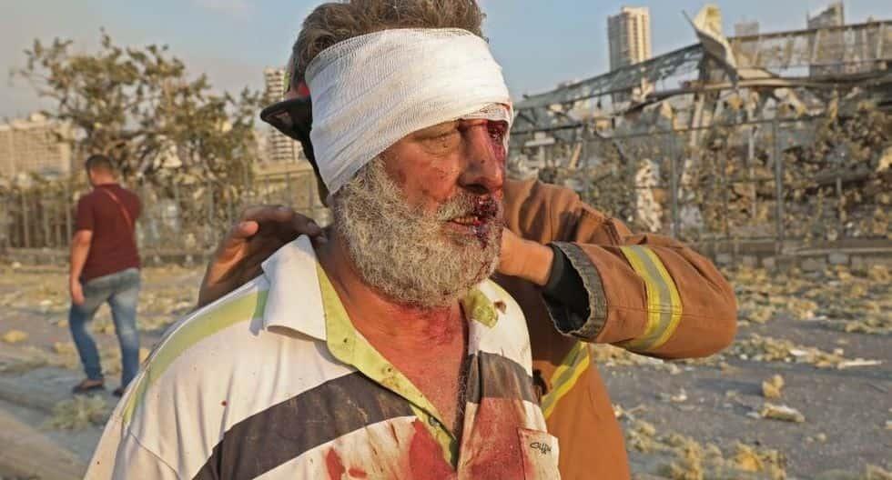 Cimbra explosión Beirut, hay 73 muertos