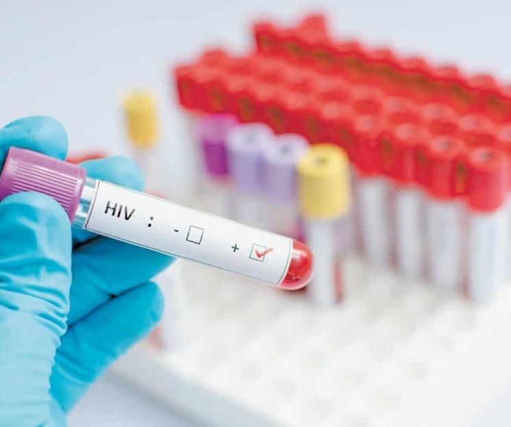 Tratamiento con proteínas sintéticas conduciría cura de VIH