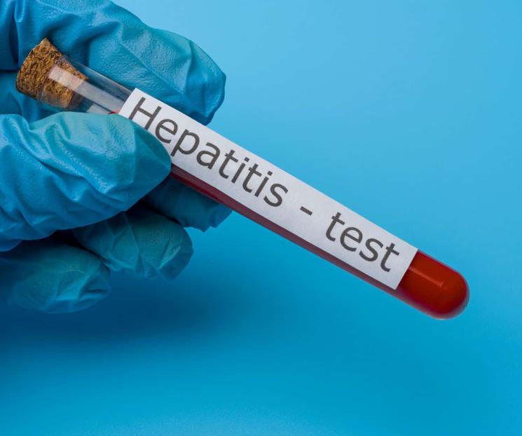 Registran brote de hepatitis vírica tipo C en Yucatán
