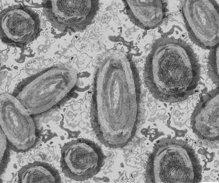 Confirma Edomex 5 casos de viruela del mono