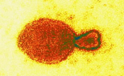 ¿Qué tan peligrosa es nueva Henipavirus detectada en China?