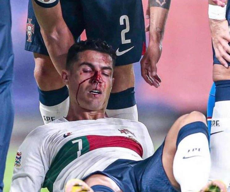 Sufre CR7 sangrado en la nariz en goleada de Portugal