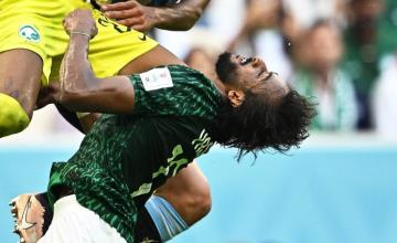 Operan a jugador de Arabia Saudita por fractura en rostro