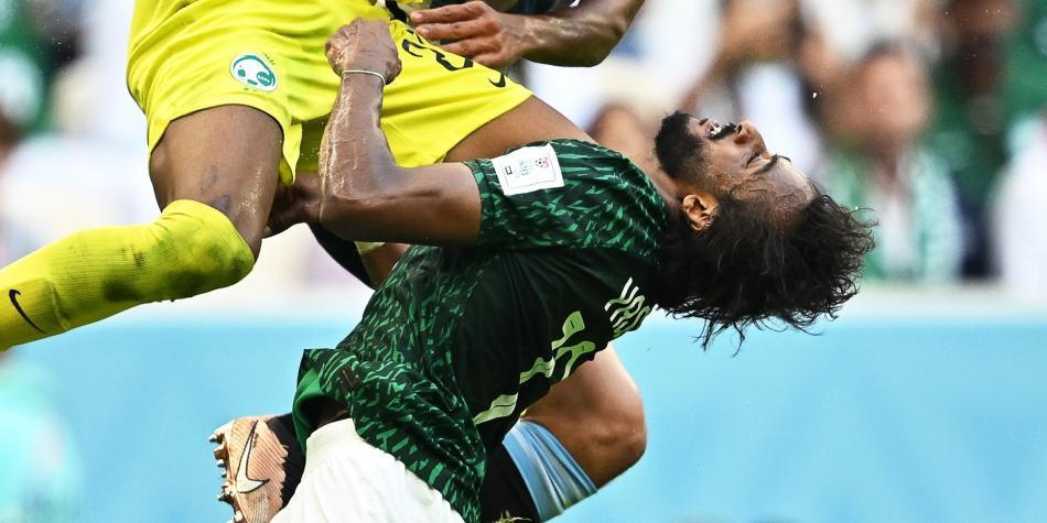 Operan a jugador de Arabia Saudita por fractura en rostro
