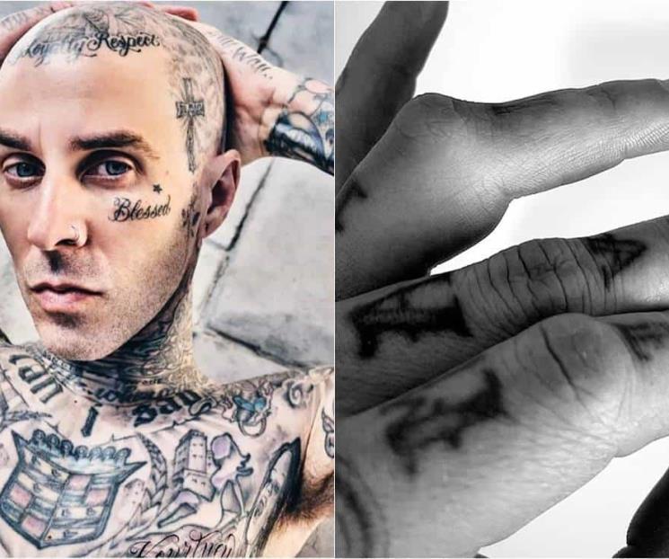 Travis Barker publica una foto de su dedo fracturado