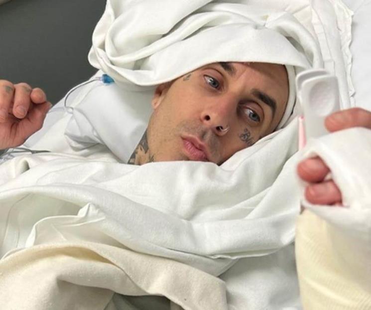 Travis Barker sube foto de la operación en su dedo