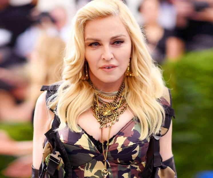 Busca Madonna quitarse cirugías estéticas