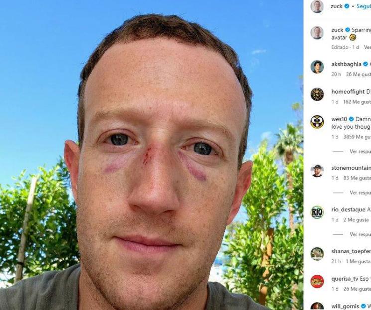 Mark Zuckerberg aparece con moretones en la cara