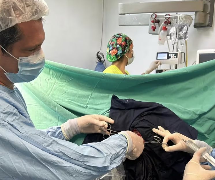 Operan despierto y extirpan tumor a un joven de 15 años en Argentina