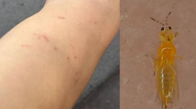 Descarta experto de UANL plaga de mosquitos en NL