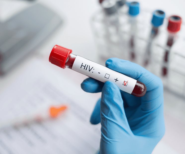 Mueren en Reino Unido 3mil personas por recibir sangre con VIH