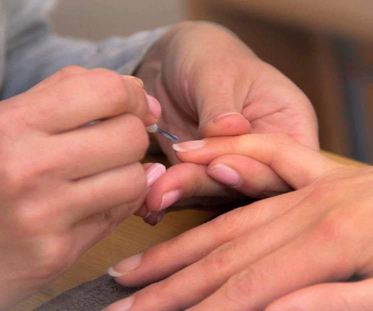 ¿Por qué aparecen estrías en las uñas de las manos?